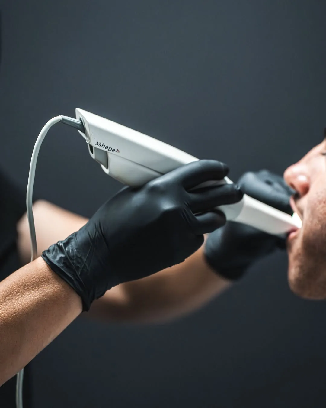 A gloved practitioner uses a handheld digital scanner to scan an adult's teeth.