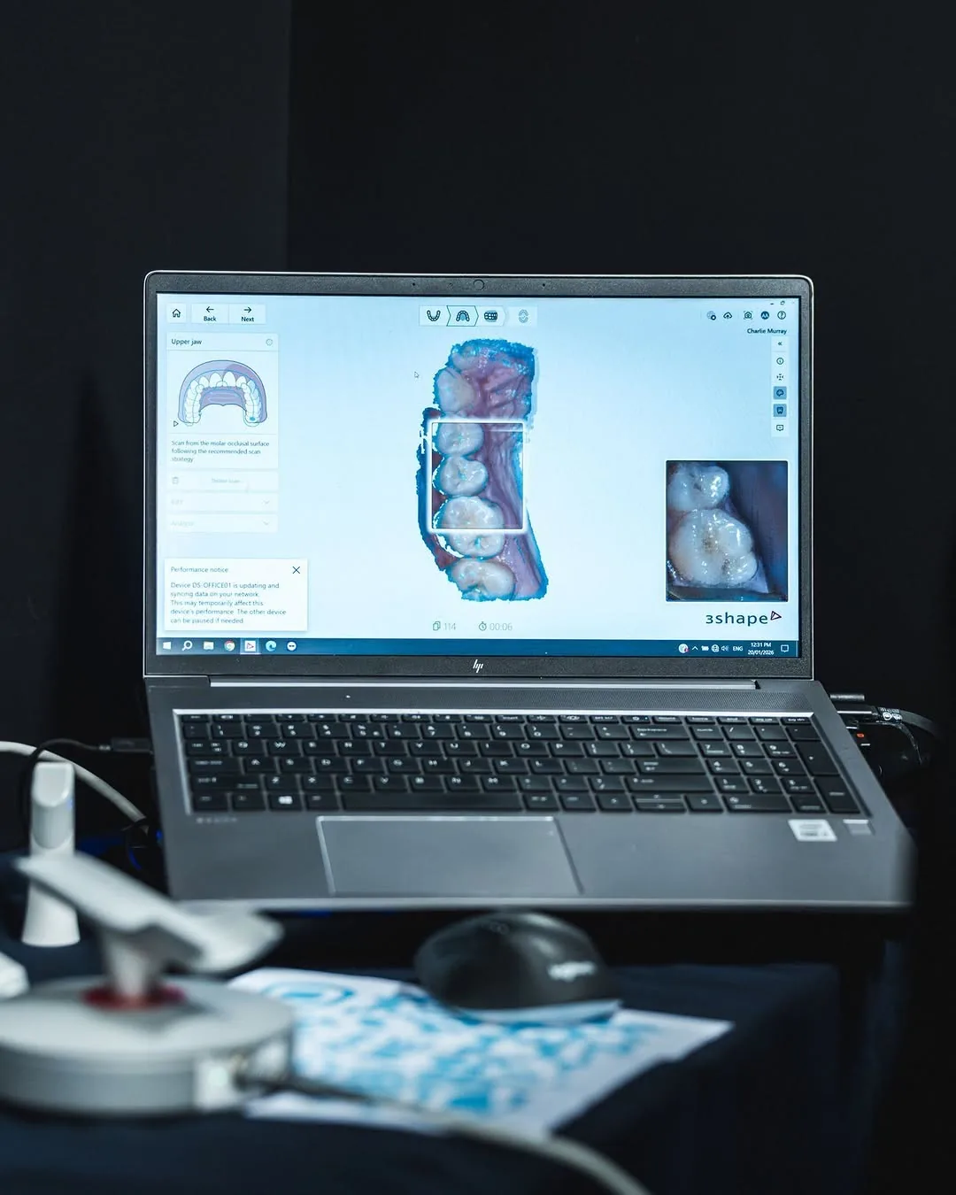 A player's 3D scan of his teeth on the laptop screen beside the handheld scanner.